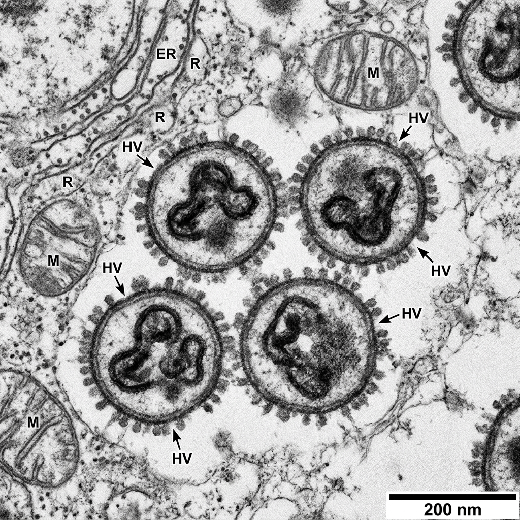 Hantavirus